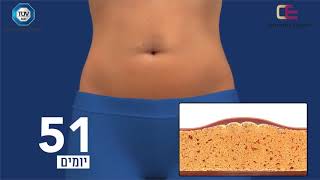 CRYO SLIM    COSMETICS EXPRESS