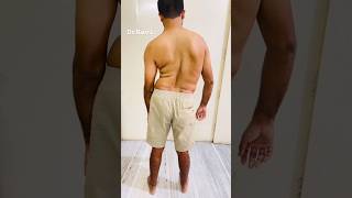 Scoliosis treatment #scoliosistreatment #scoliosisawareness #spine #chiropractic #physio #kyphosis