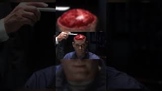 "Hannibal" Dinner of a live human brain