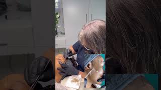 Truth about chemical peels, best at the end. #chemicalpeels