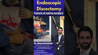 Endoscopic Discectomy || Dr. Dheeraj Batheja || Artemis Hospital #spinesurgeryindelhi