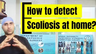 How to detect #scoliosis in a child? रीढ़ की हड्डी का कुबड़ खुद डायग्नोज करे।#deformity #spine #pain