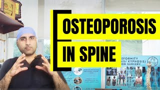 Osteoporosis fracture of spine explained! क्या है हड्डियां को खोखला करने की बीमारी? #pain  #fracture