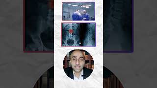 What is treatment of Osteoporosis? क्या इलाज है कमजोर हड्डियों का? #spine #backpain #fracture #pain