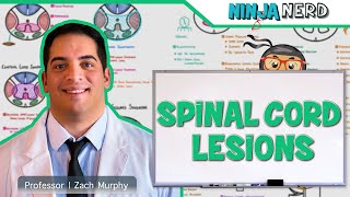 Spinal Cord Lesions: Anterior Cord, Posterior Cord, Central Cord, Brown-Séquard