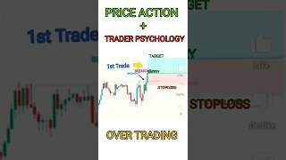 The ULTIMATE Stock Market Strategy for Beginners! STOPLOSS Explained      shorts#ytshort#stockmarket