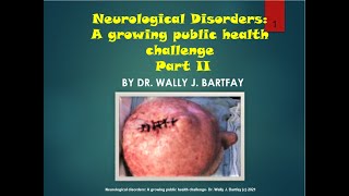 Neurological Disorders Part II- By Dr. Wally J. Bartfay (c) 2021