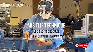 2-Level Minimally Invasive Transforaminal Lumbar Interbody Fusion