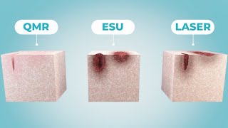 QMR Technology in Surgery  (English version)