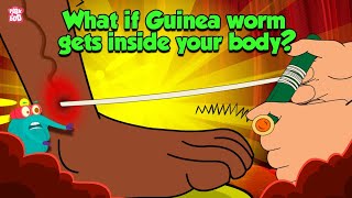 Deadliest Parasite | What if Guinea Worm Gets Inside Your Body? | Dracunculiasis | Dr Binocs Show