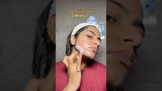 How to use tretinoin for acne? #tretinoincream #pharmacy #acneproneskin #acnejourney