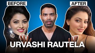 Has Urvashi Rautela Undergone Plastic Surgery? | Transformation Explained