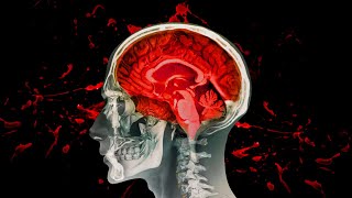 Brain Rot is Ruining your Life