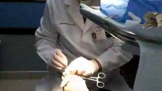 Ingrown Toenail Surgery